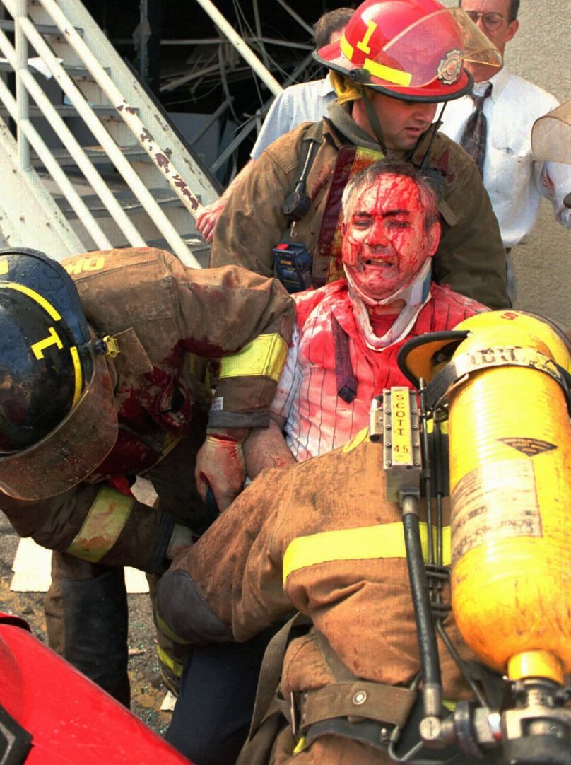 Firefighters attending to an injured man with blood on his face and shirt, in an emergency rescue situation.