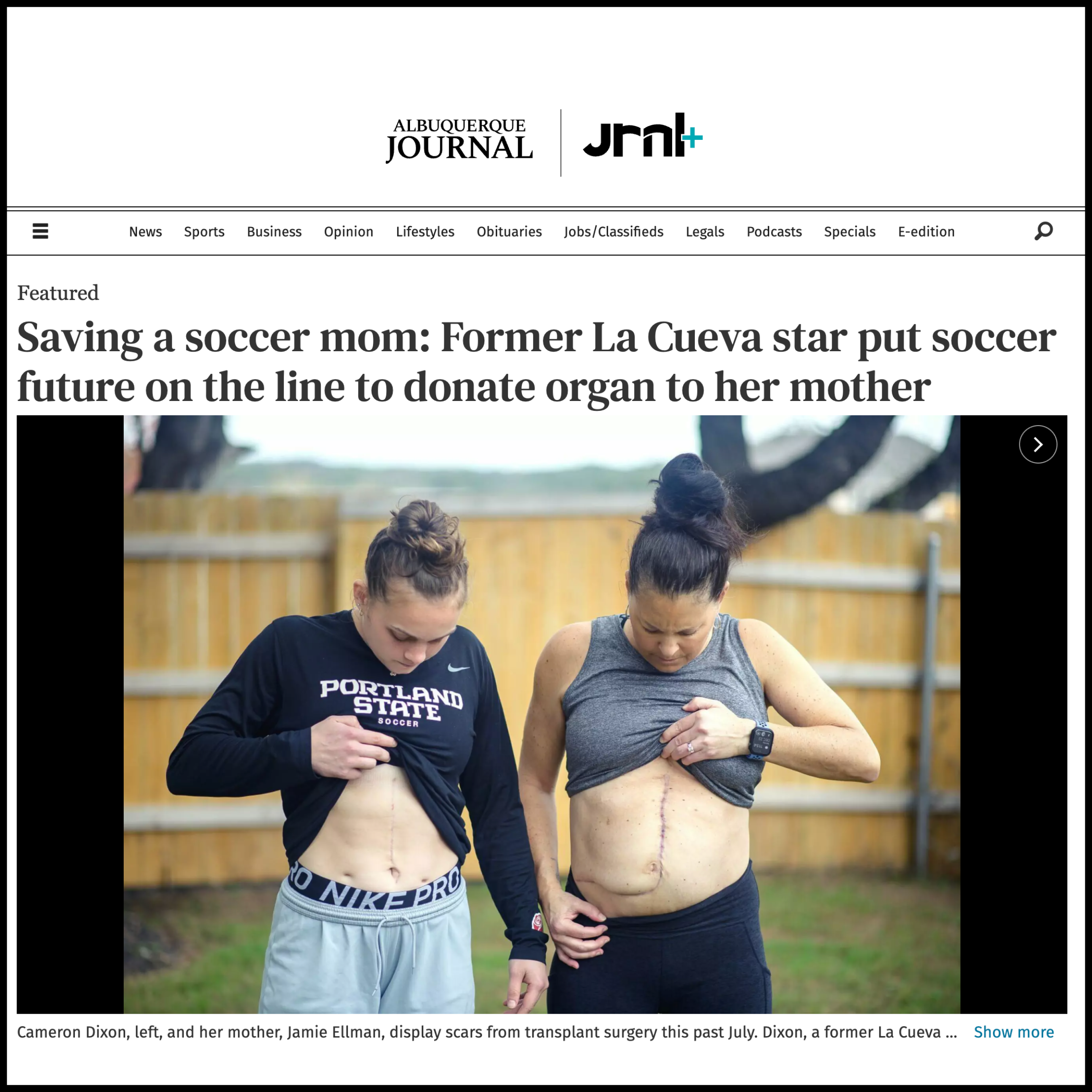 Two women showing their abdominal surgical scars, one wearing a Portland State soccer shirt and the other in a gray shirt, standing outdoors near a wooden fence.