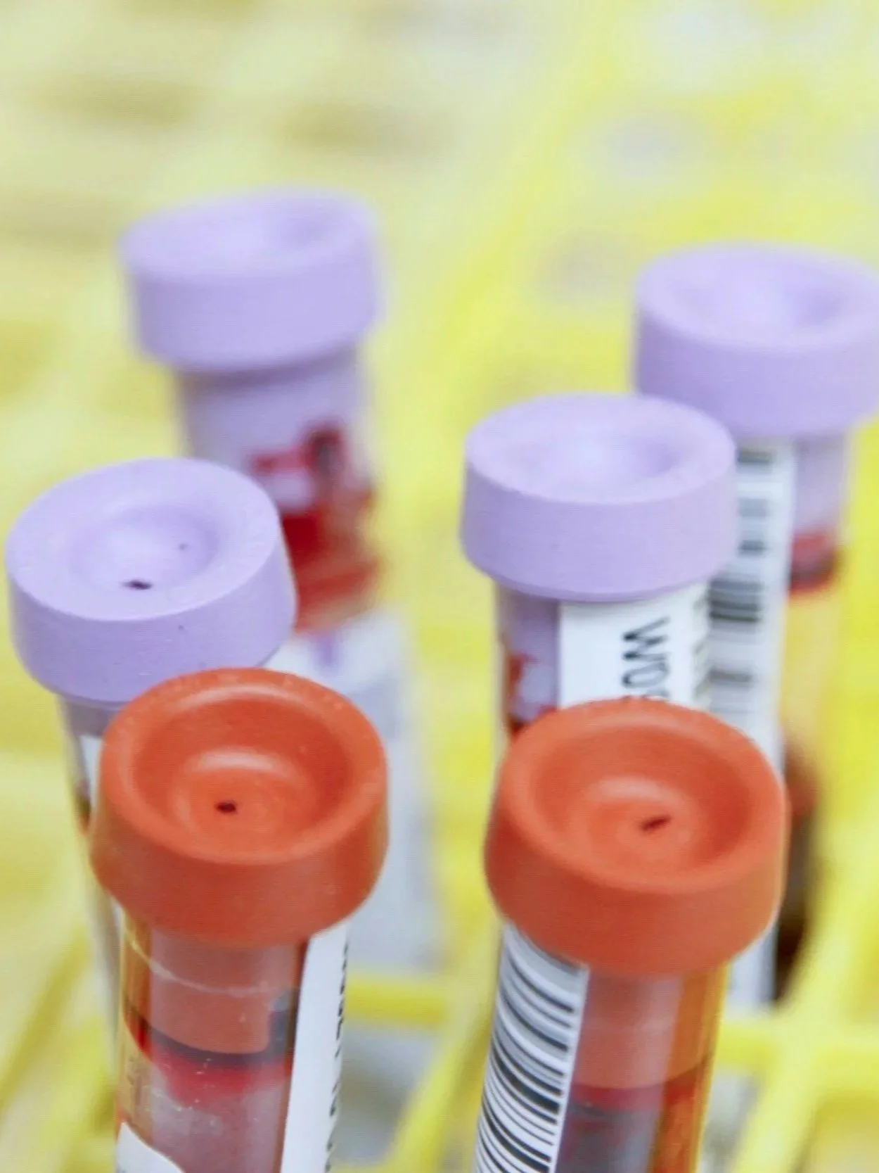 Close-up of orange and purple medication capsules with barcodes on a yellow background.