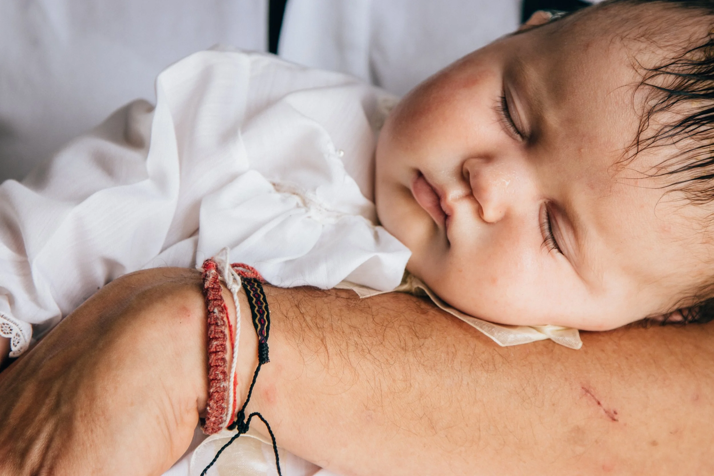 A young boy is sleeping with his head resting on an adult's arm, with a small surgical scar visible on the arm.