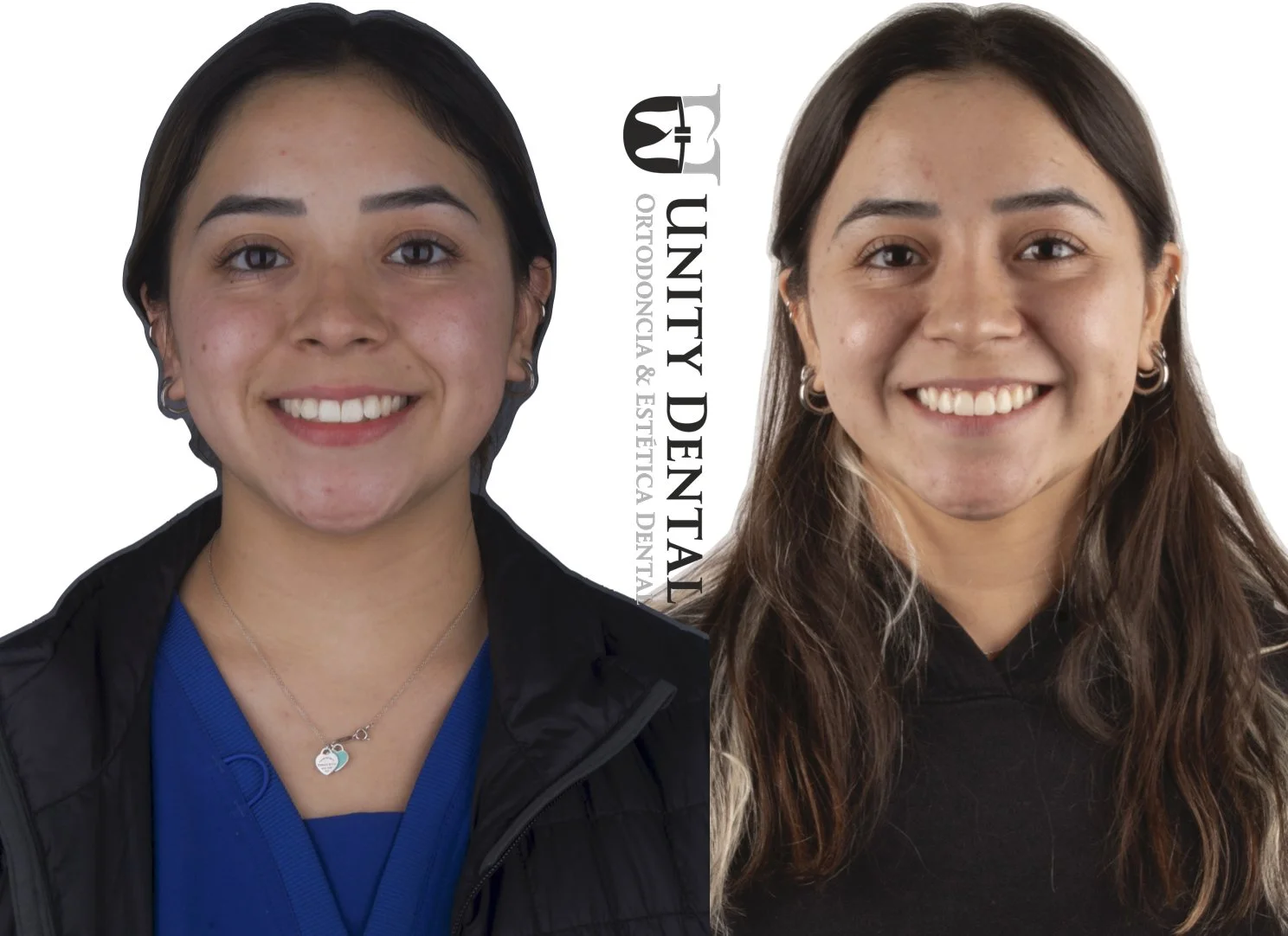 Side-by-side photographs of  young women with smiling face. This is a comparison of before and after orthodontic treatment at Unity Dental in Mexicali