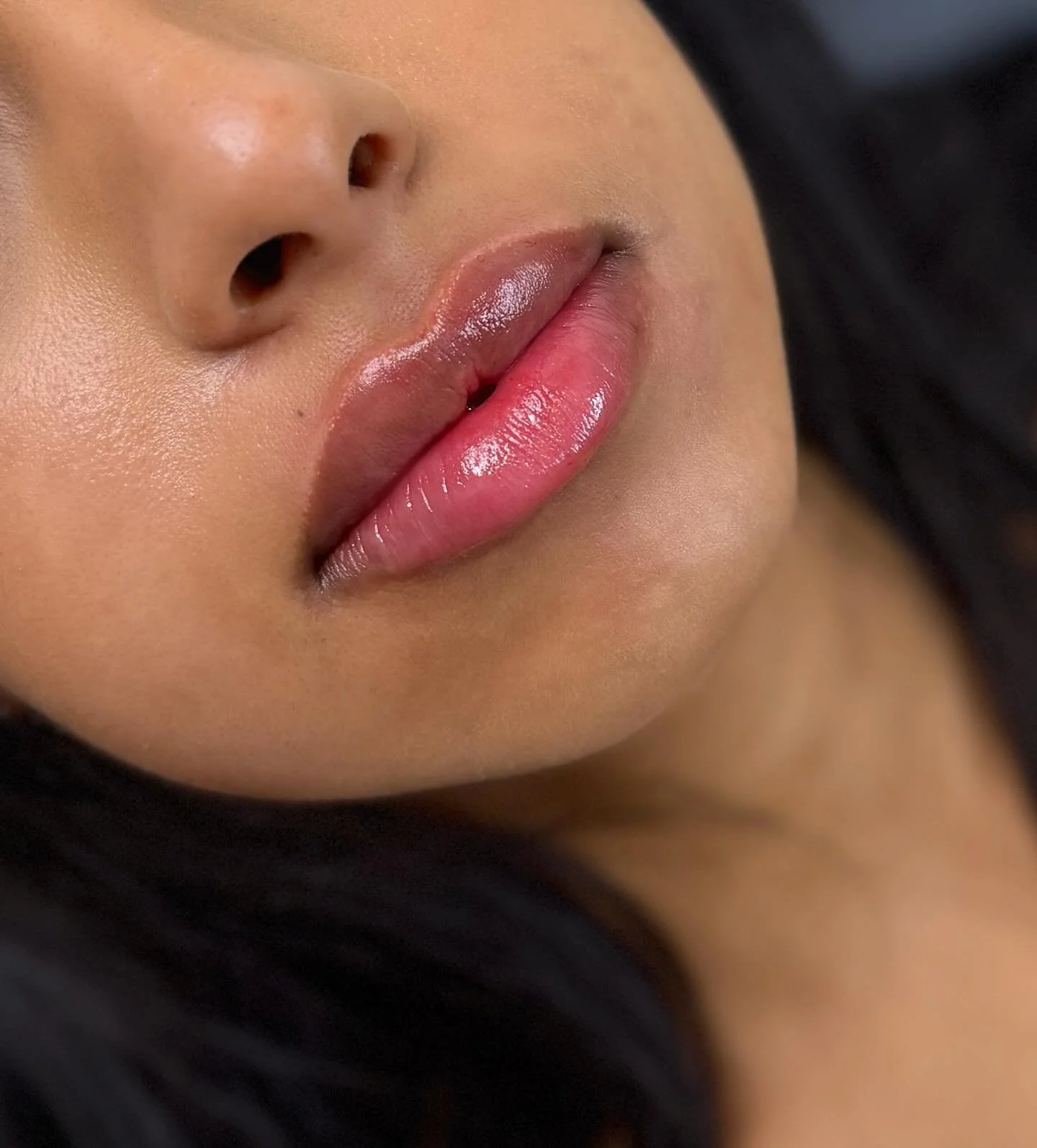 LIPS💋

A fuller, more defined pout for this first time lip filler client. 

Swipe to see the before. 

Lips by Michelle.