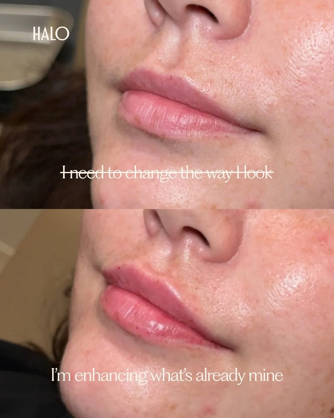 A little mindset shift. ✨

Taking care of yourself doesn&rsquo;t have to come from a place of wanting to &ldquo;fix&rdquo; something. Sometimes it&rsquo;s simply about choosing treatments that make you feel good, support your skin long-term, and fit 