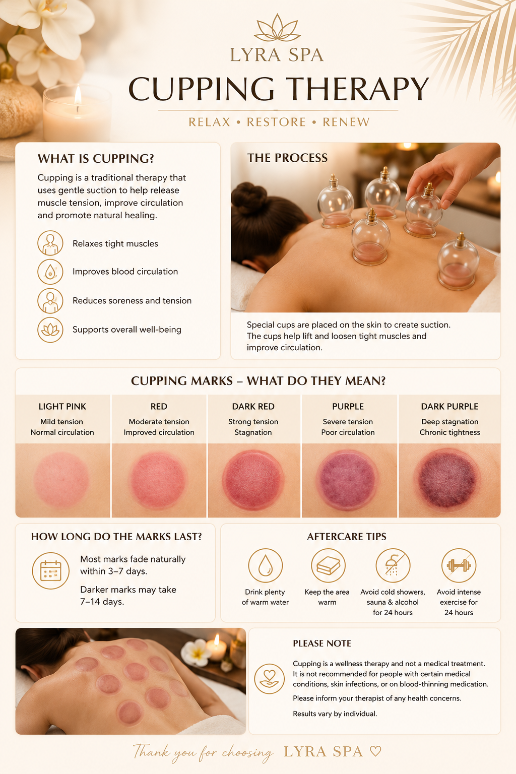 Cupping Therapy