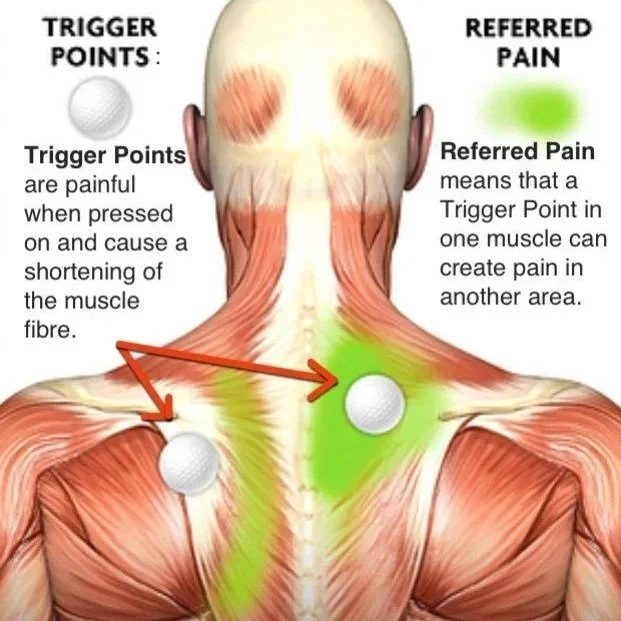 Trigger point massage therapy in Palo Alto at Avy Spa for neck and shoulder pain relief