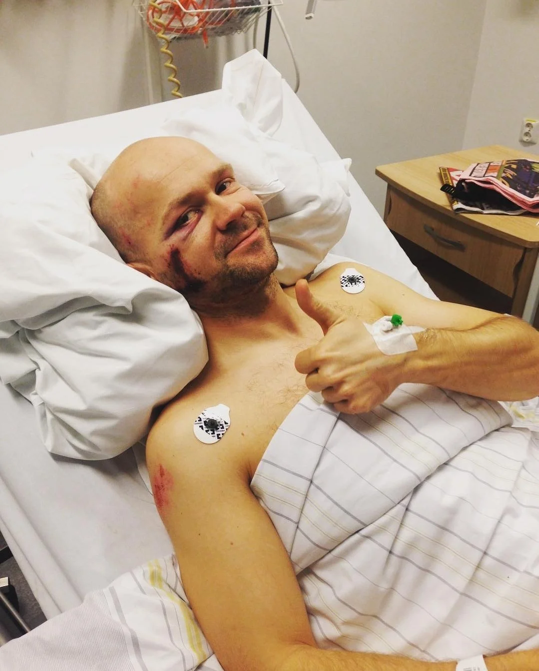Coach Jørstad på sykehus med 3 brudd i ryggen