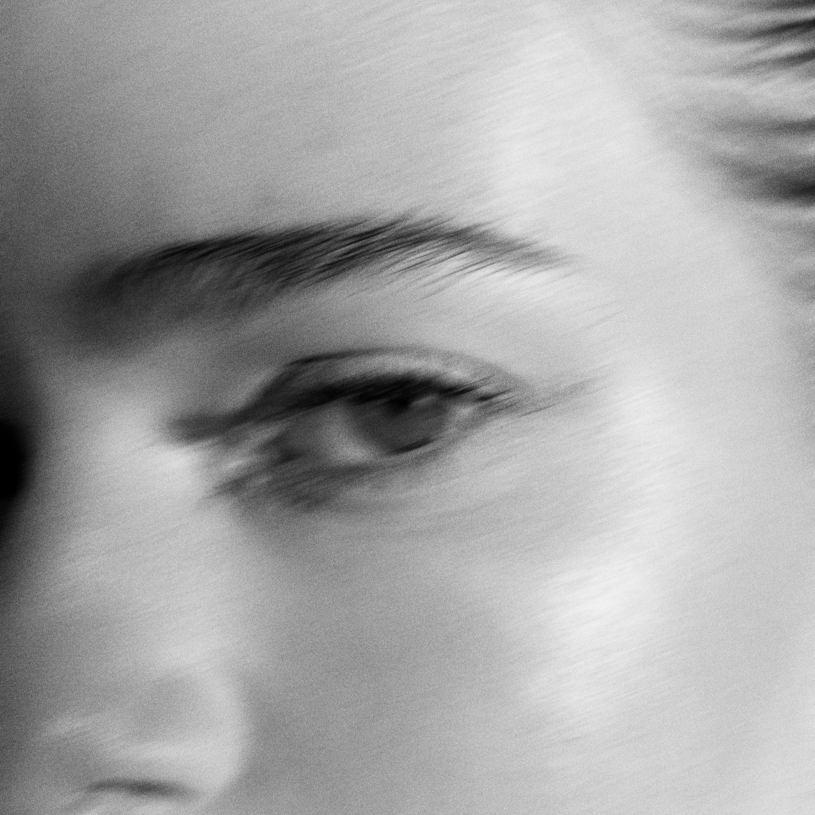 Why Eye Drops Aren't Fixing Your Dry Eye (And What Actually Will)