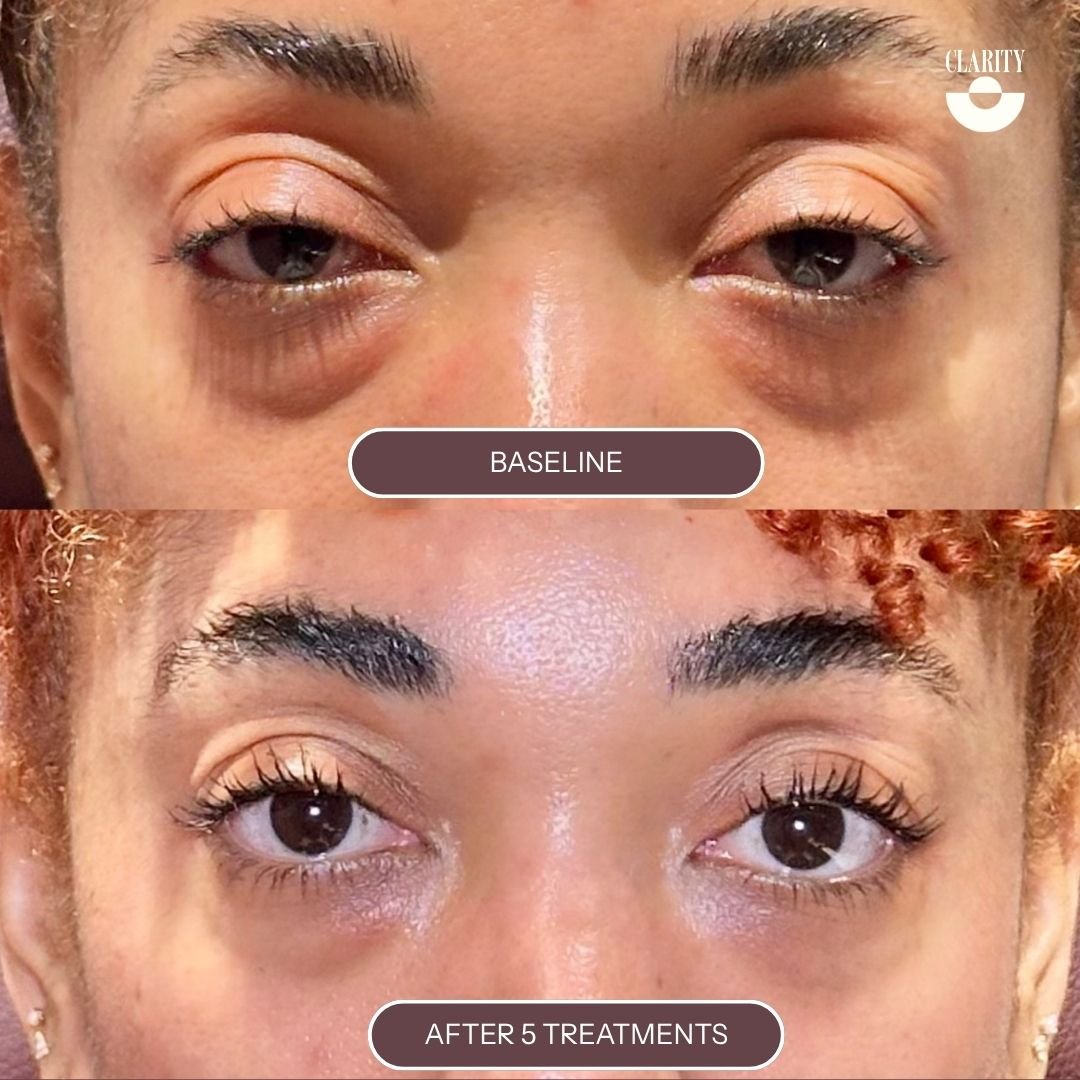 TreatmentProgress (1).jpg