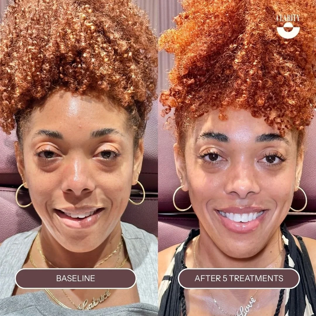 TreatmentProgress (2).jpg