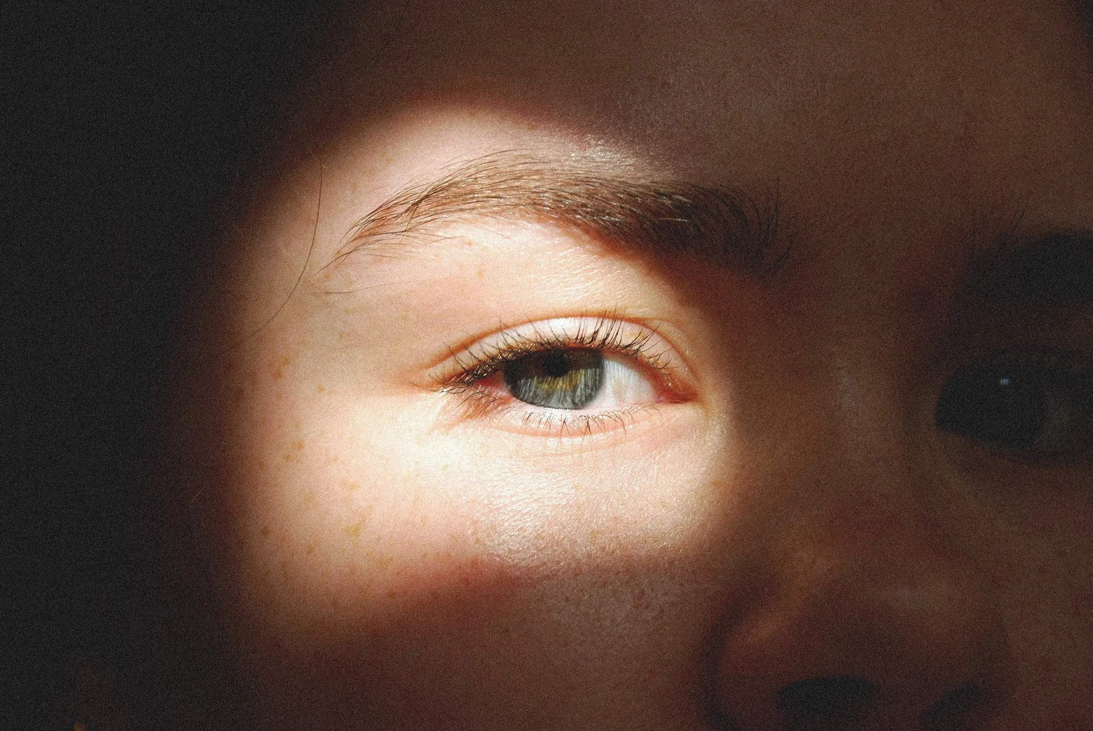 Close-up of a person's face, showing one eye with brown and green coloring, and light skin with freckles. The eye is partially covered by a shadow.