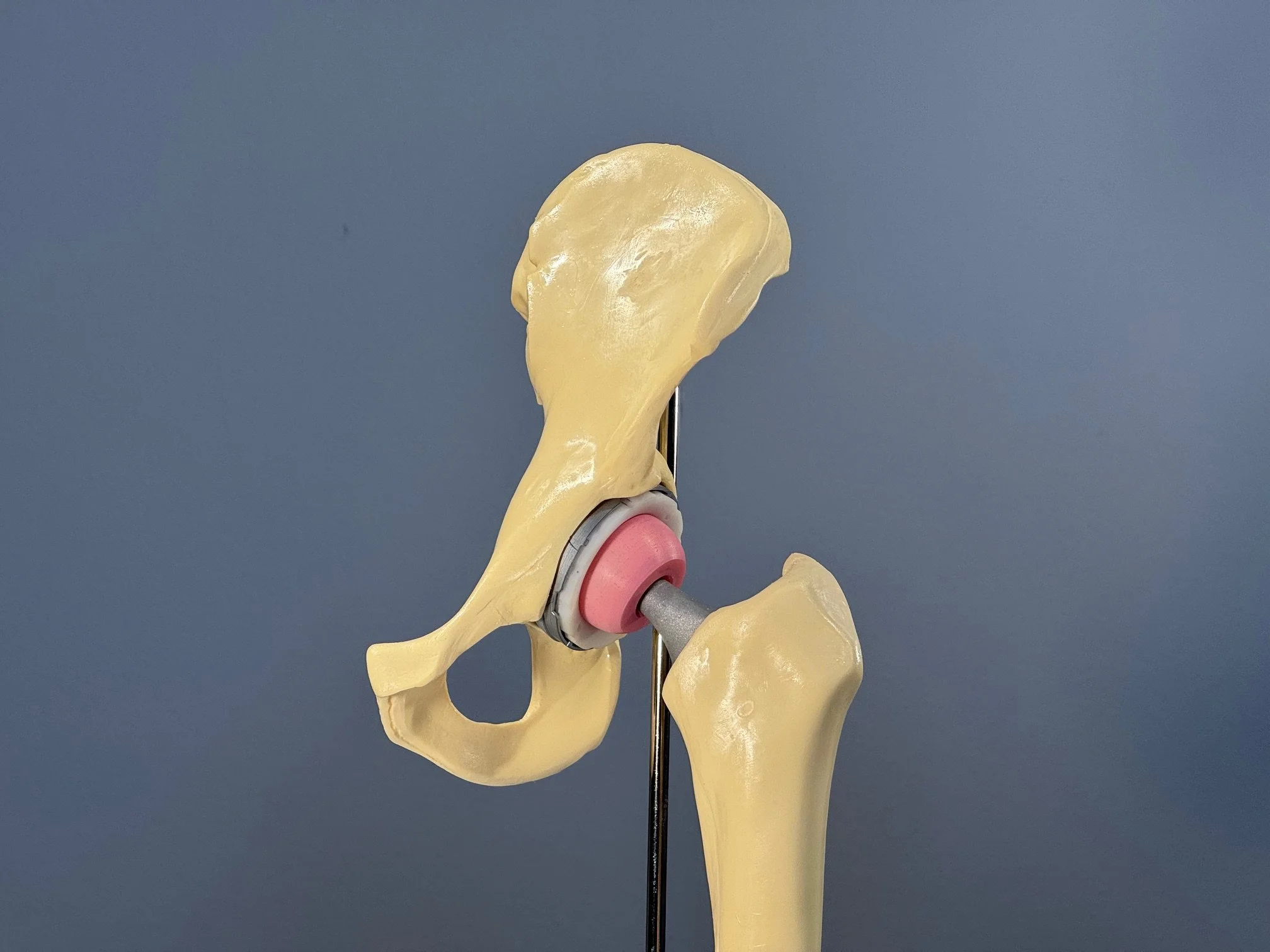 Sex After Hip Replacement