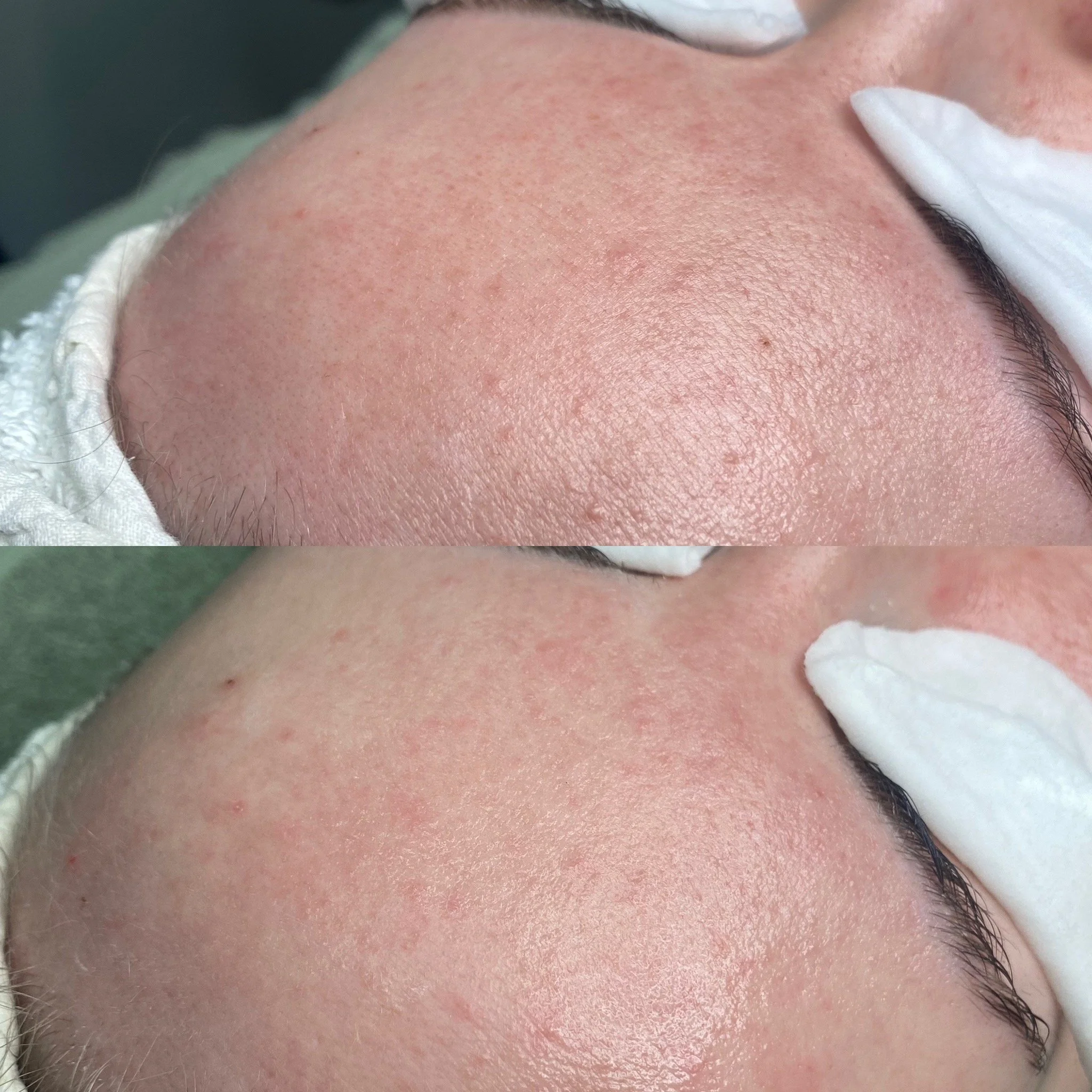 Yksi BiON Signature Expert kasvohoito kauneushoitolassa.