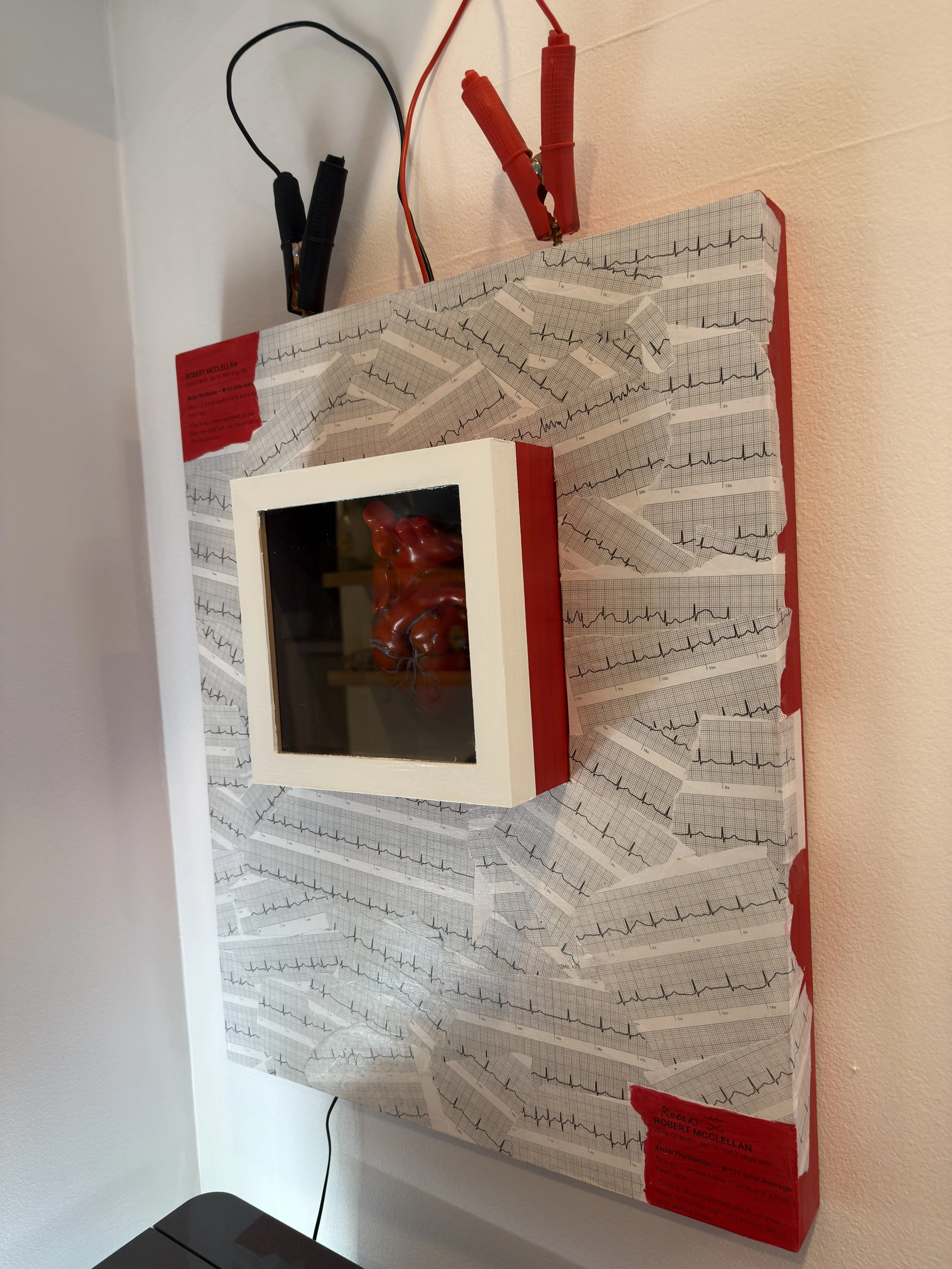 Self Portrait With AFIB