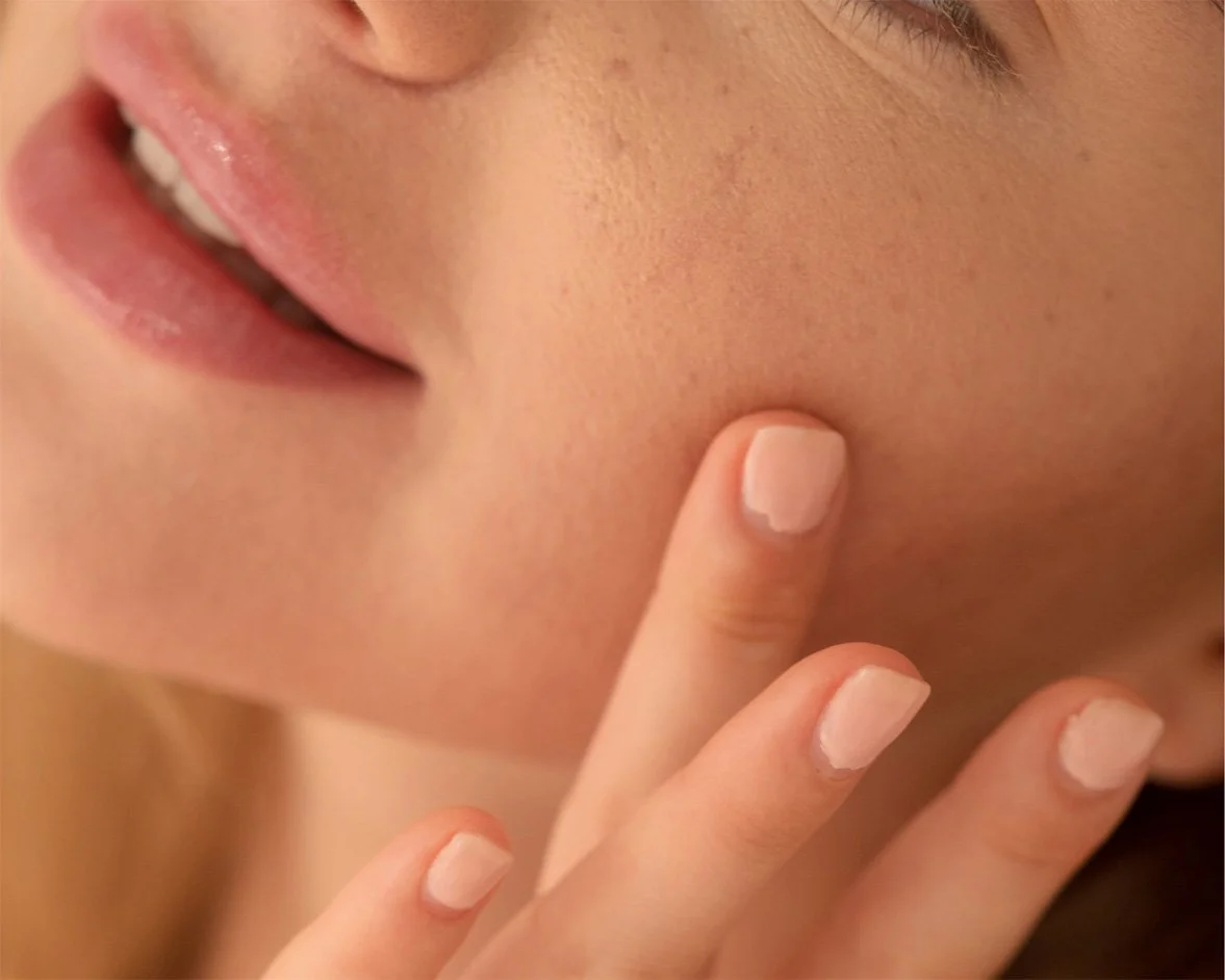 Medspa in Calabasas, CA 91302 l Microneedling with PRP Near Me