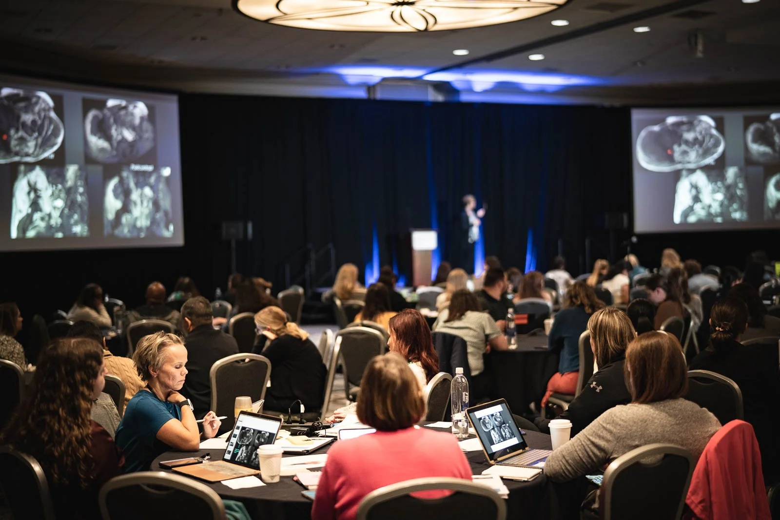 Crowded conference room with a speaker on stage displaying medical images