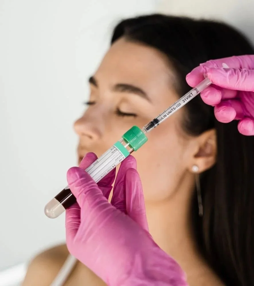 Regenerative PRP skin treatment in SYV