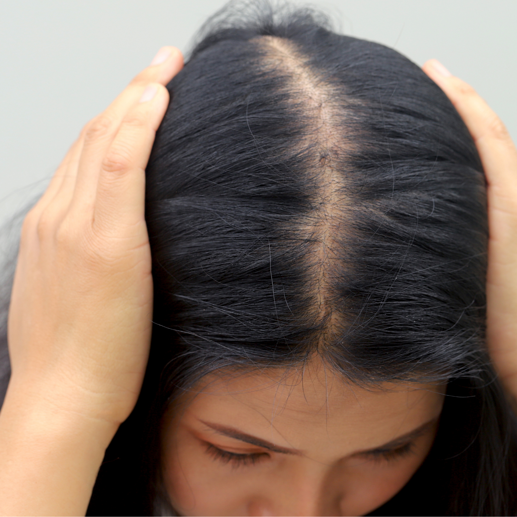 Hair Loss in Women: What It Really Feels Like (And Why It Affects So Much More Than Appearance)