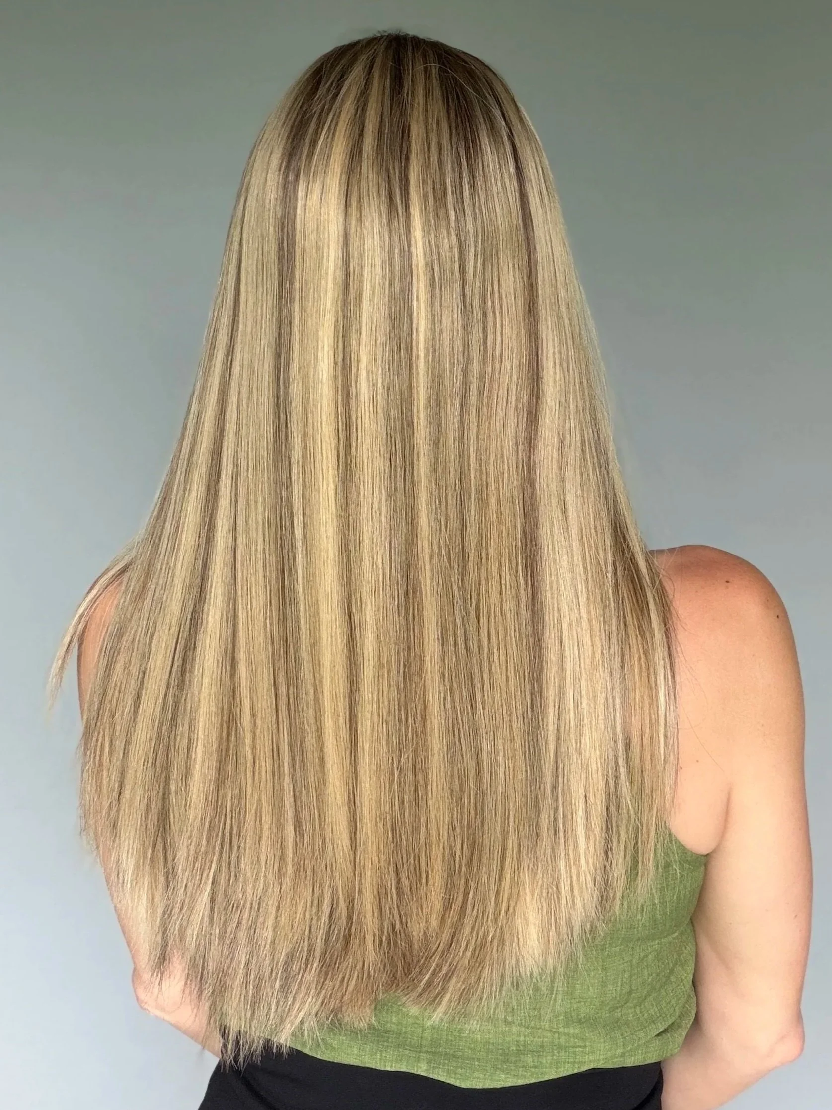 hair loss boston