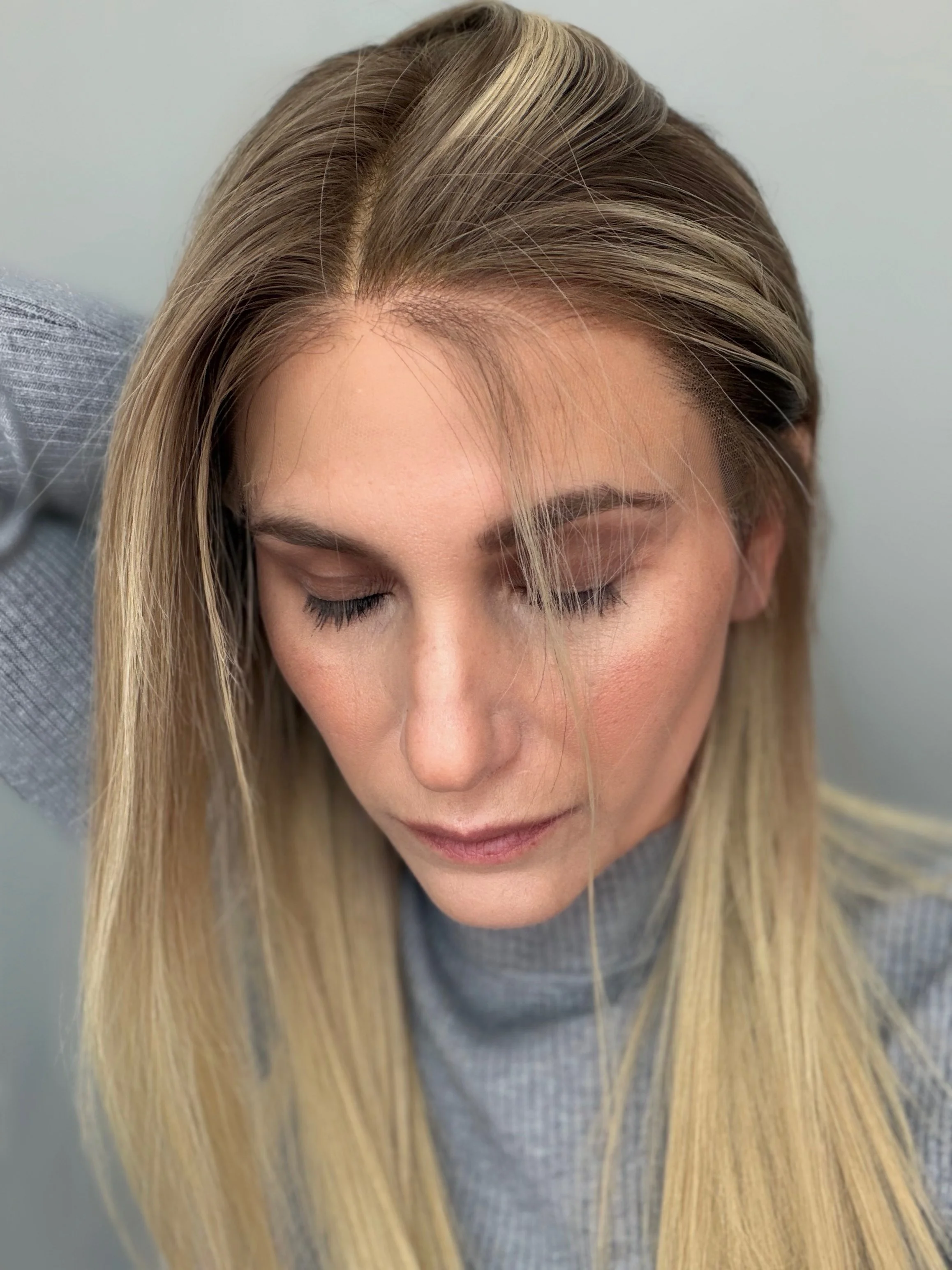 Boston wigs for hair loss