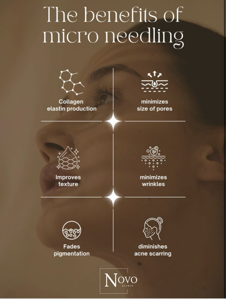 Infographic highlighting the benefits of micro-needling, including collagen and elastin production, pore size minimization, texture improvement, wrinkle reduction, fading pigmentation, and acne scarring diminishment, with a woman's face in the background.