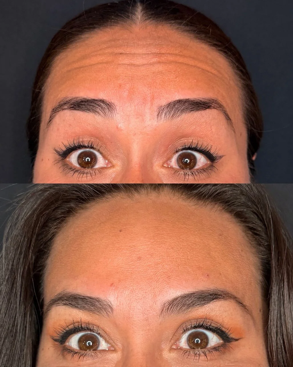 Show Your Momma How Much You Love Her this Mother&rsquo;s Day&hellip; with less wrinkles 😉💕 

The Mother&rsquo;s Day Sale is Now Live at Lumi&eacute; until 5/31✨
- enjoy tox discounted at $10/unit &amp; buy 40units get a FREE lip flip✨💕 

Book you