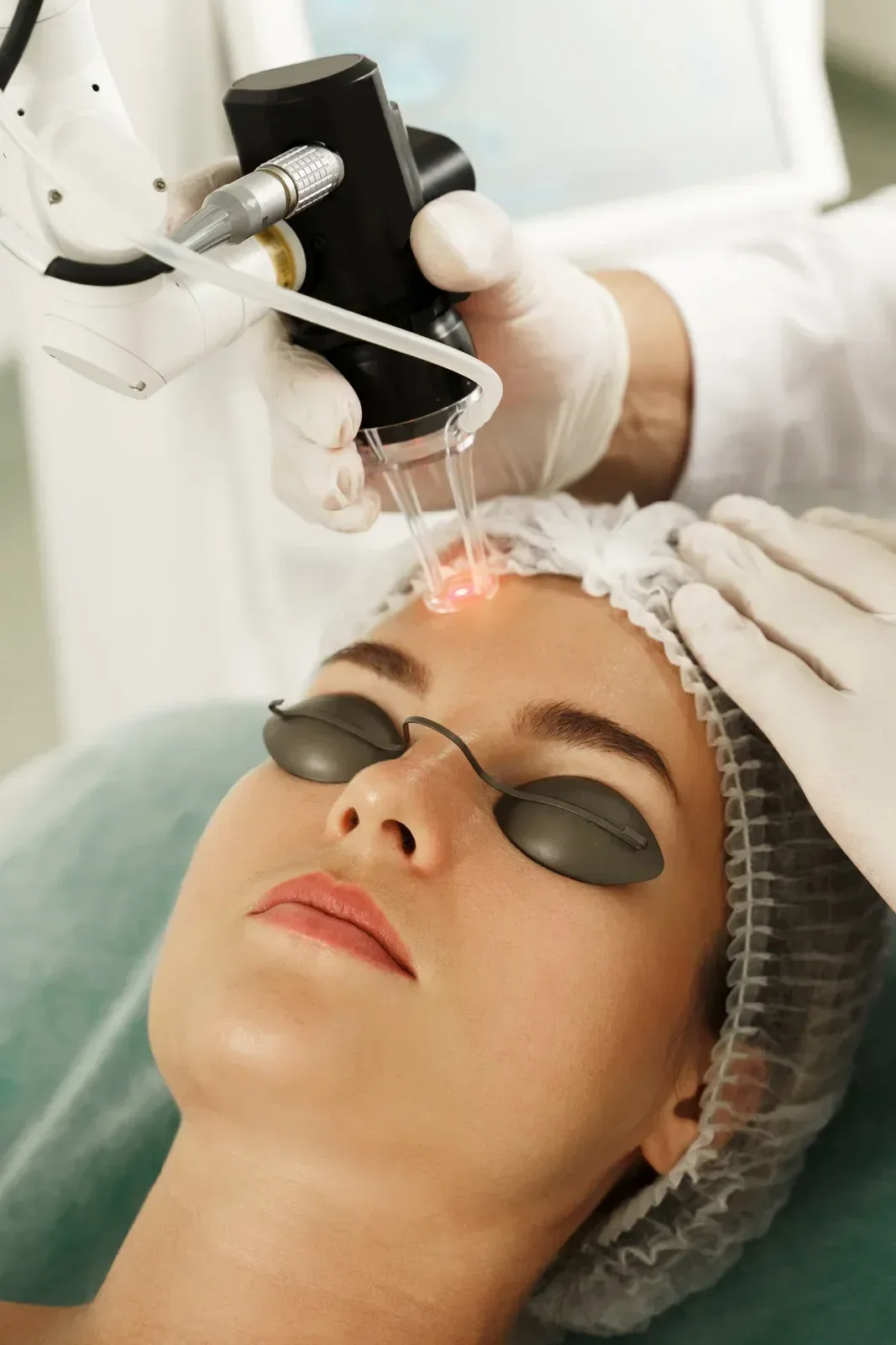 Woman receiving laser treatment on her forehead wearing protective eye glasses
