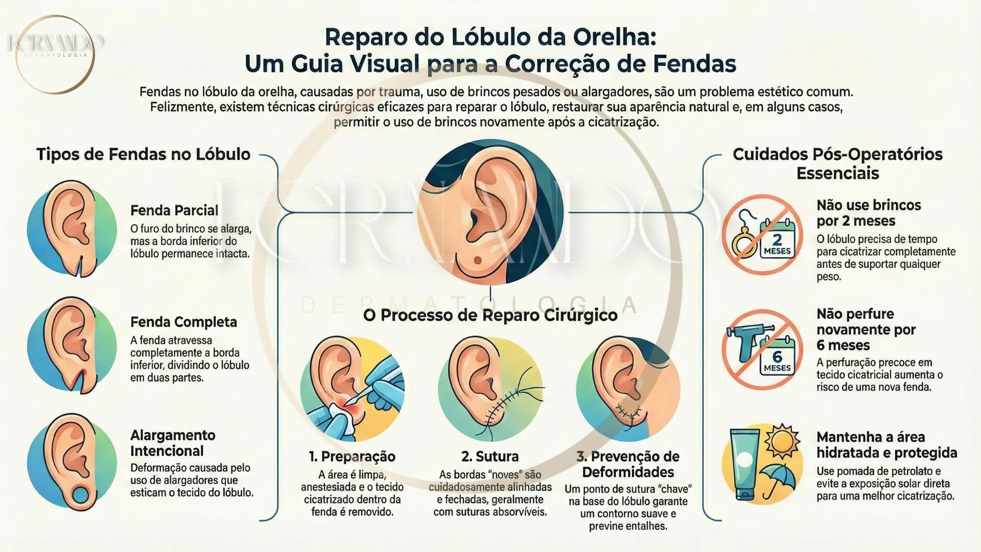 Infográfico mostrando os tipos de fenda de orelhas, como é feito o reparo cirúrgico e como deve ser feito o manejo no pós-cirúrgico.
