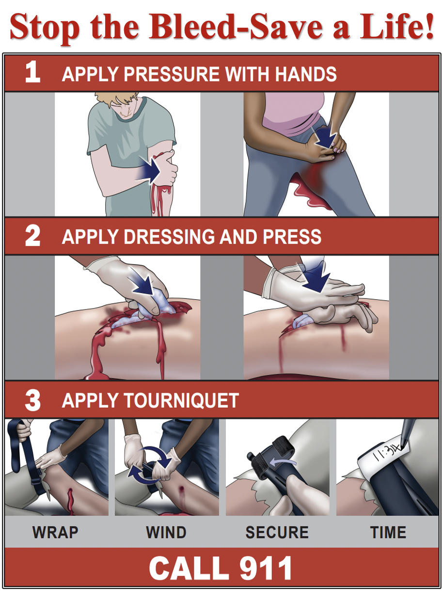 Stop the Bleed steps to control bleeding