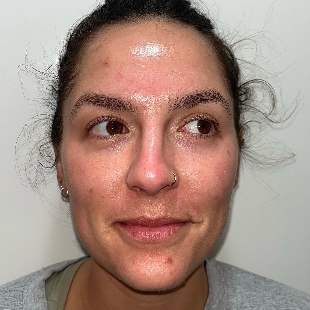 Second Treatment
