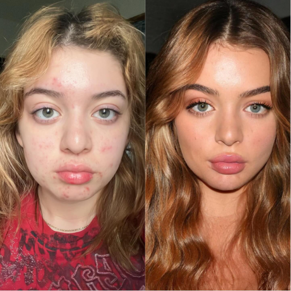 Comparison photo of a young woman before and after makeup and skincare, showing improvement in skin clarity and facial appearance.