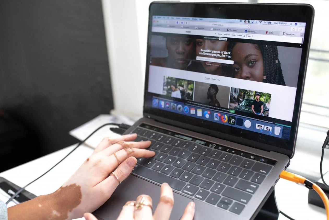 Woman'sHandsWithVitiligoAtLaptop