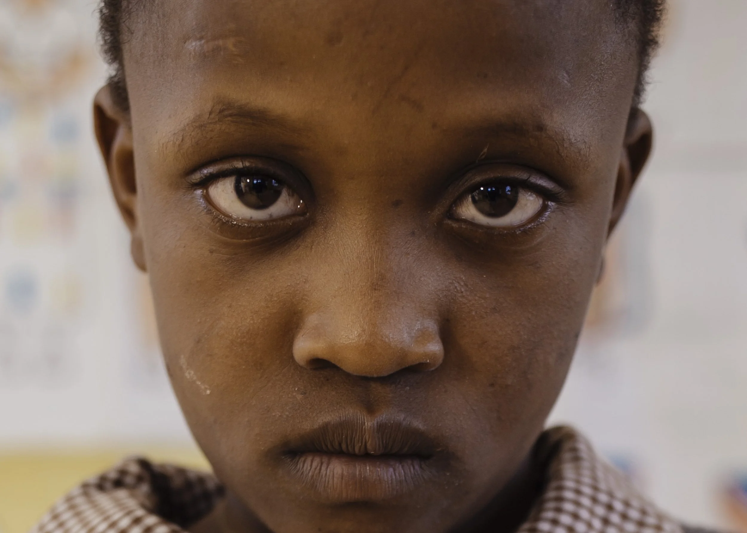 Close-up of a young boy with serious expression, dark skin, short hair, and large dark eyes, wearing a checkered shirt.