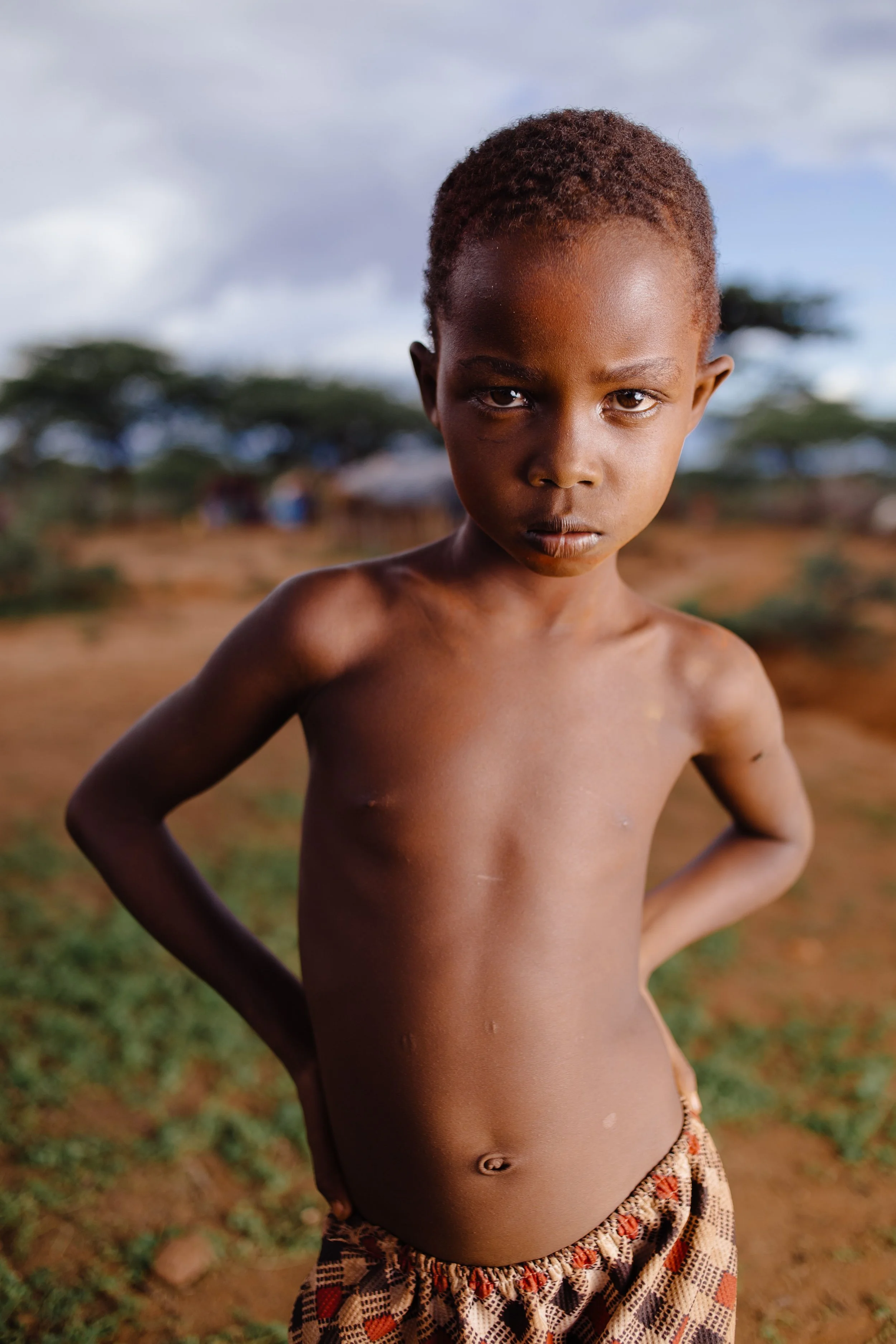 A young boy standing outdoors with a serious expression, shirtless and wearing patterned shorts, in a rural setting with trees and huts in the background.
