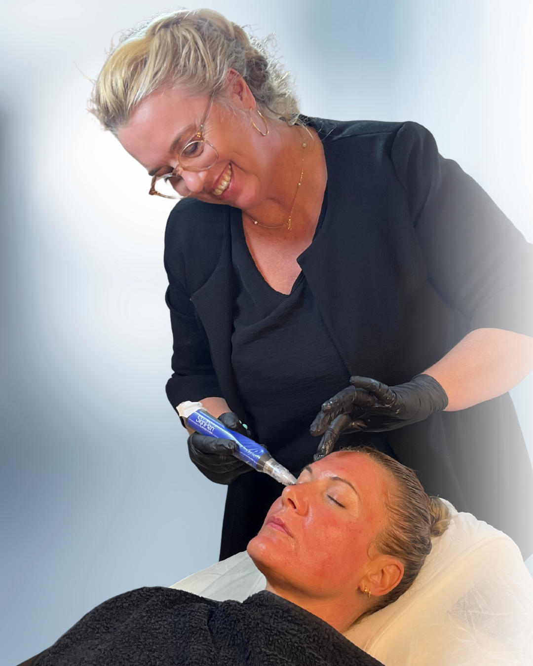 Microneedling hos Klinik Skin Rehab i Charlottenlund