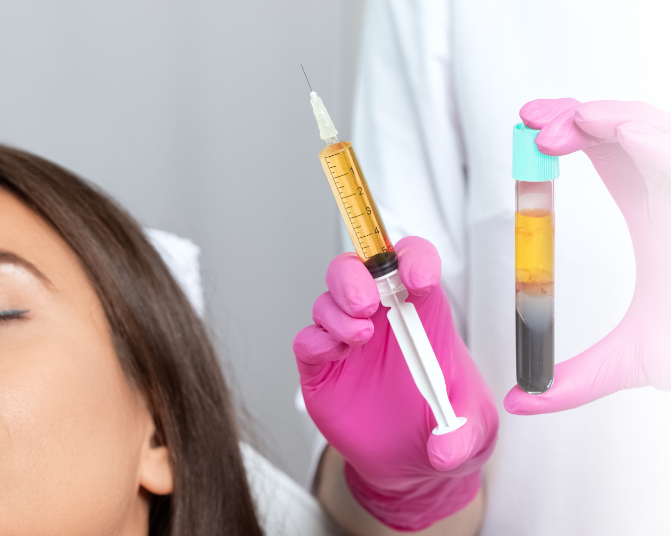 PRP PRF behandling hos Klinik Skin Rehab i Charlottenlund