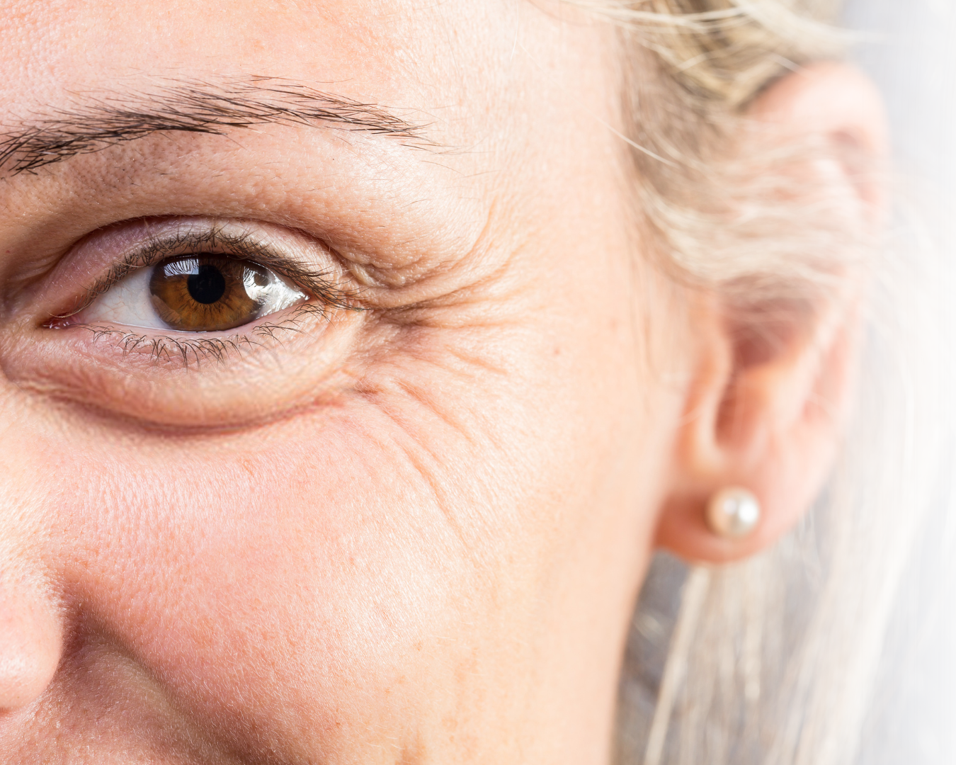 Kosmetisk klinik i Charlottenlund og Bornholm Klinik Skin Rehab kollagentråde