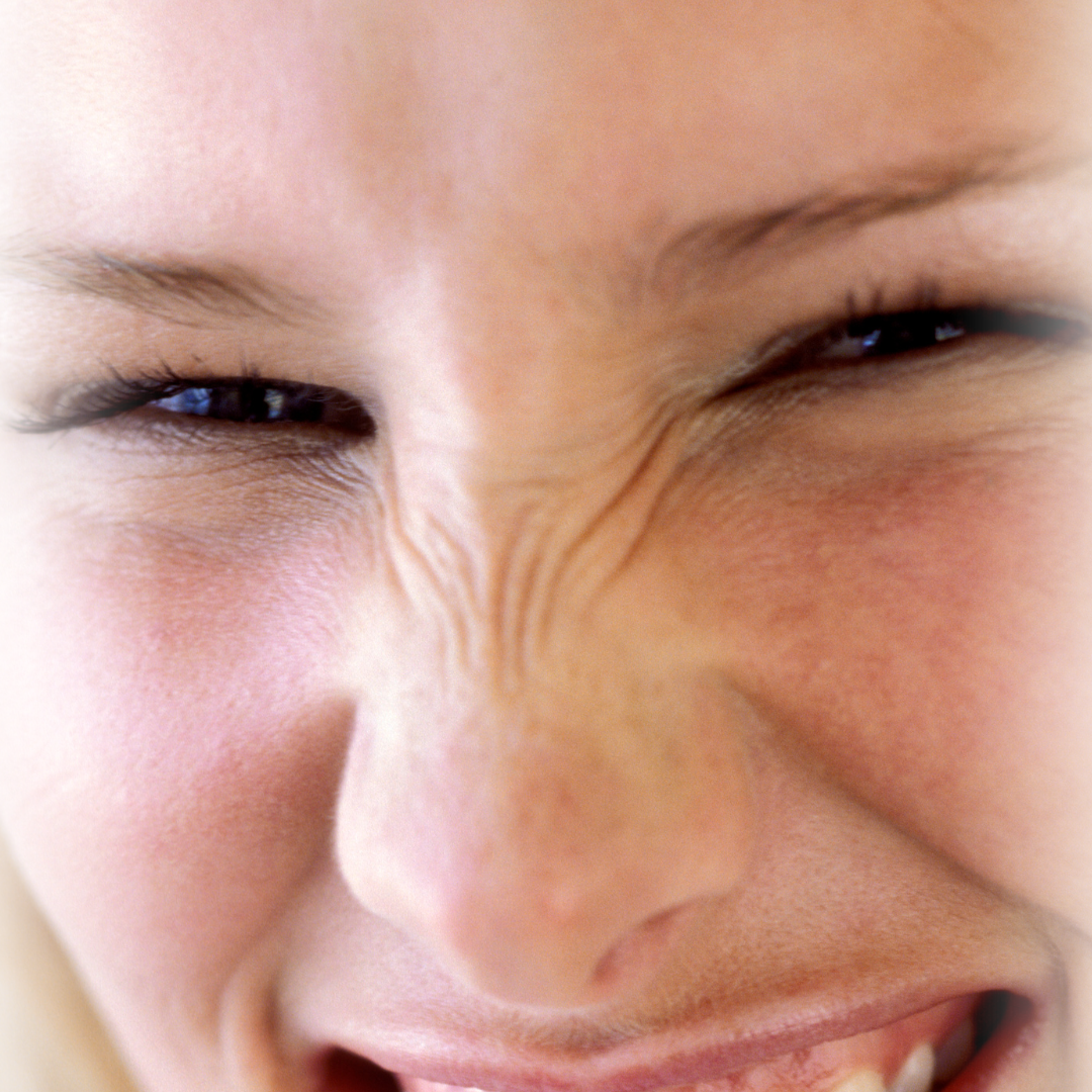 Naturlig botox behandling hos Klinik Skin Rehab i Charlottenlund