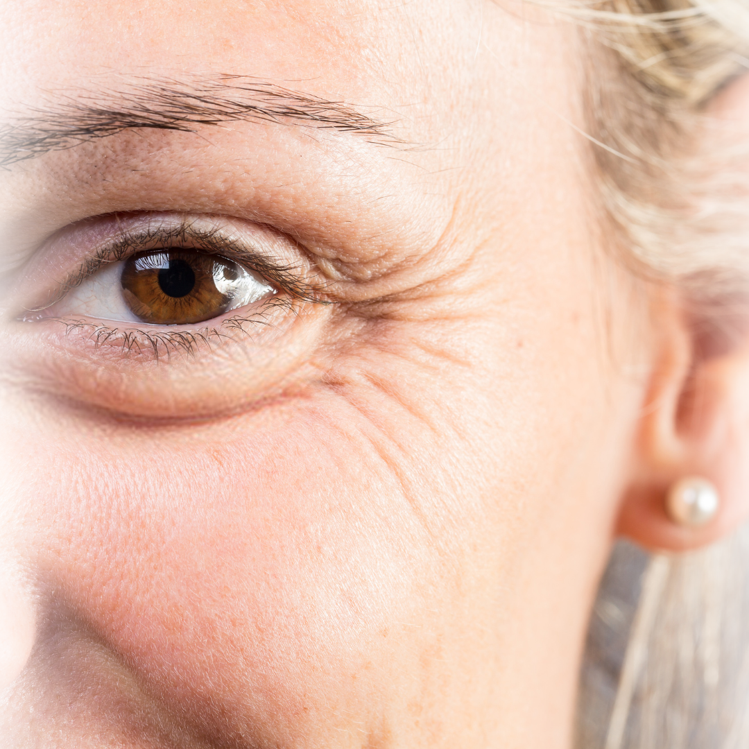 Naturlig botox behandling hos Klinik Skin Rehab i Charlottenlund