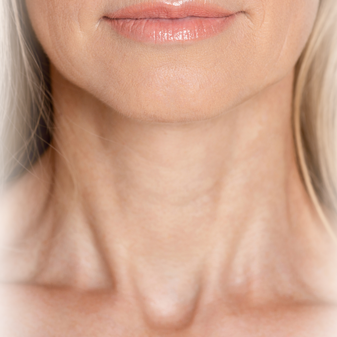 Naturlig botox behandling hos Klinik Skin Rehab i Charlottenlund