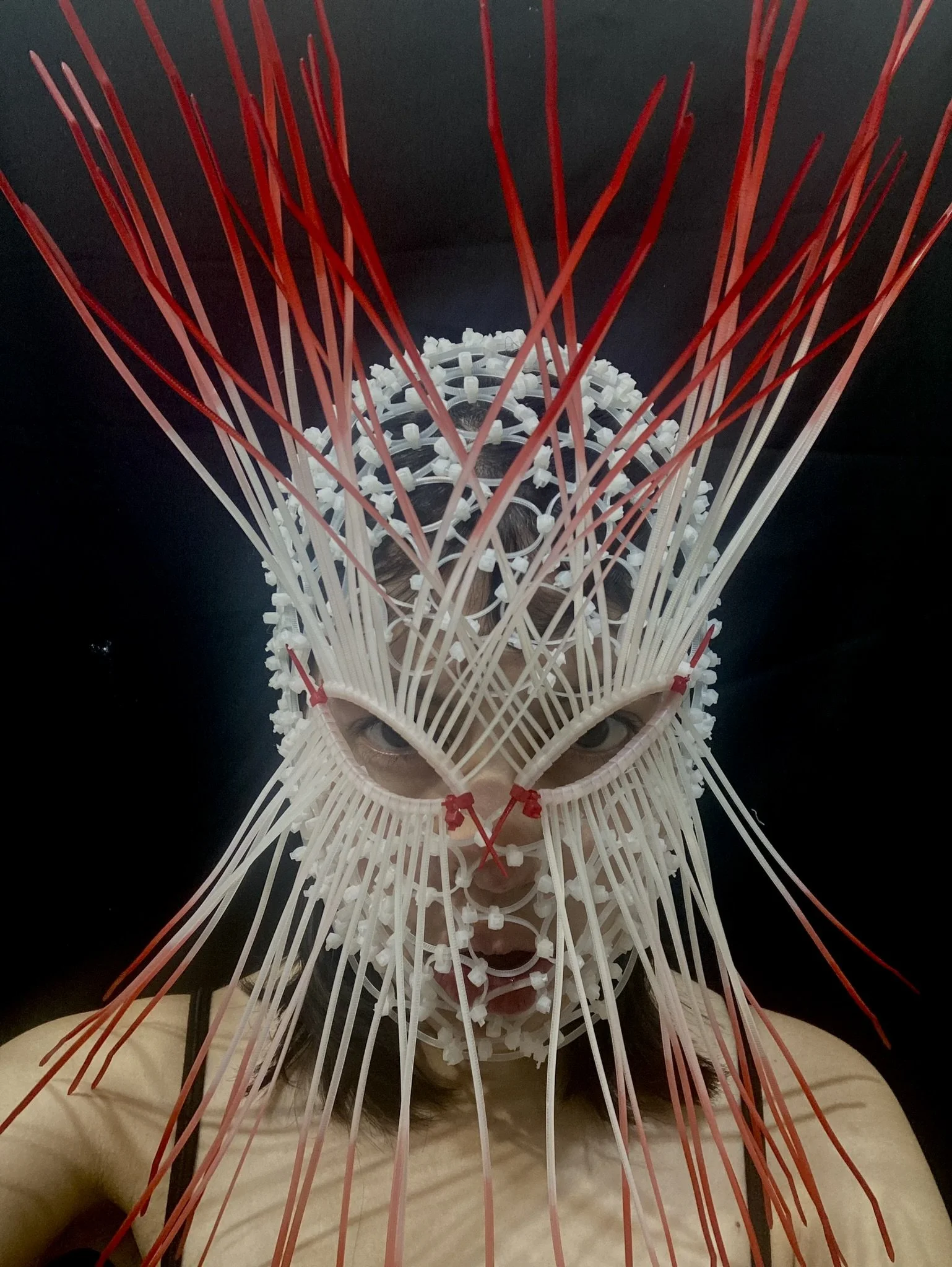 The Face of The Human Porcupine