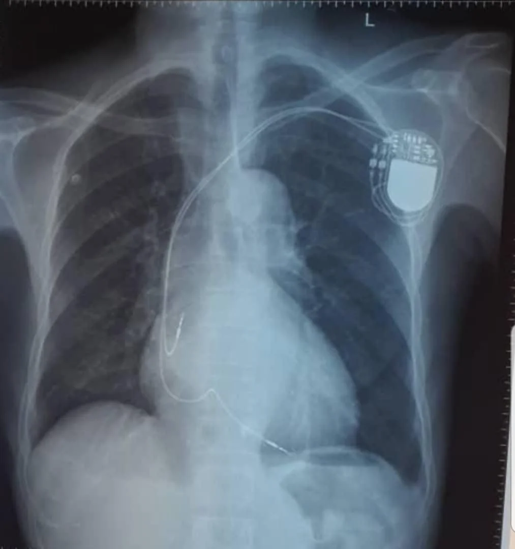 Xray Pic.jpg