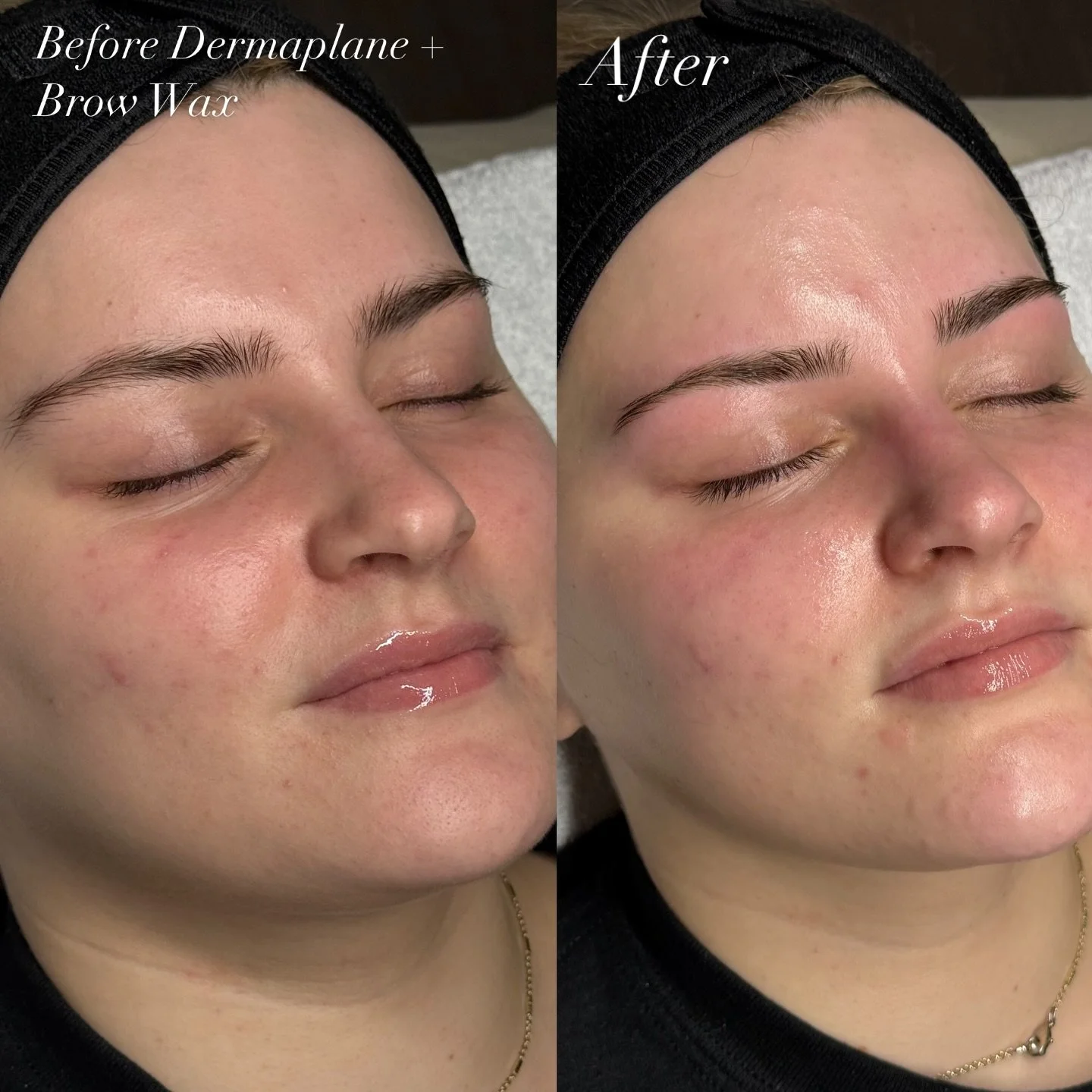 Feeling complete with a Dermaplane &amp; Brow Wax ☺️