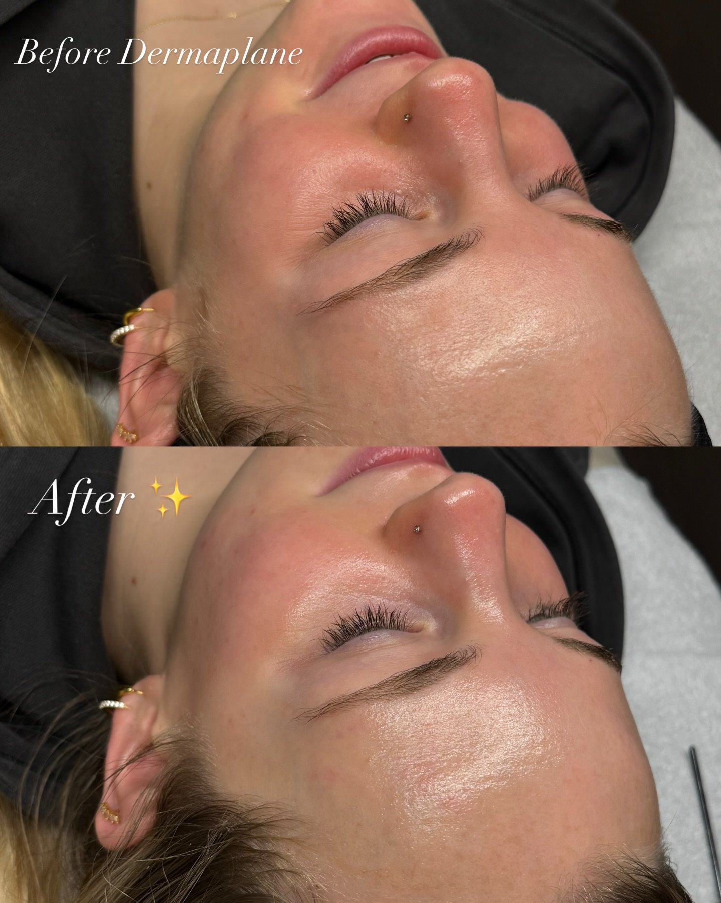 D E R M A P L A N E G L O W✨