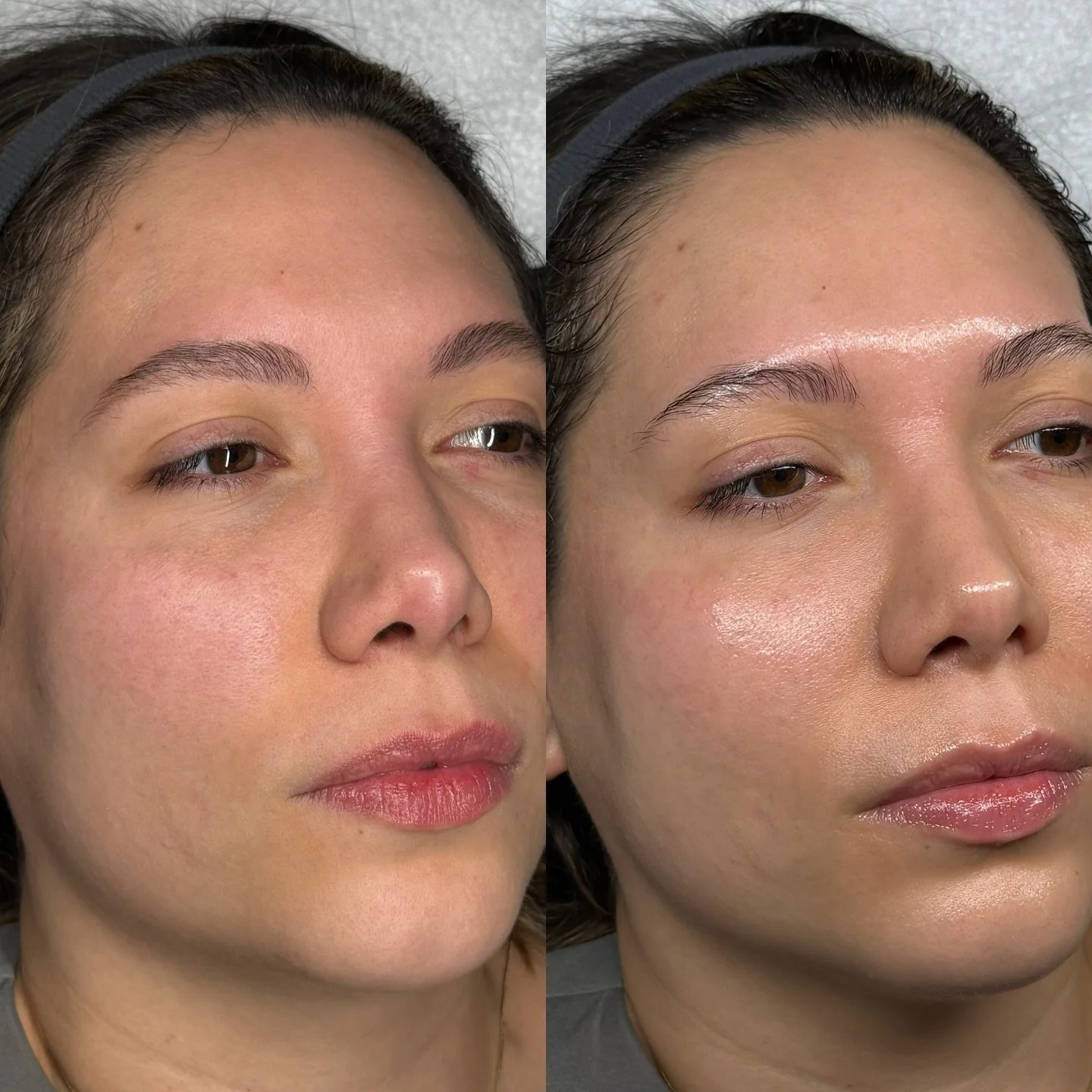 This could be YOU!! ✨👀 

_______________________
HydroDiamond facial 
Diamond Facial 
Hydrodermabrasion Facial in Columbus Ohio
Anti-aging Facial 
Facials in Columbus Ohio
Deep Pore Facial