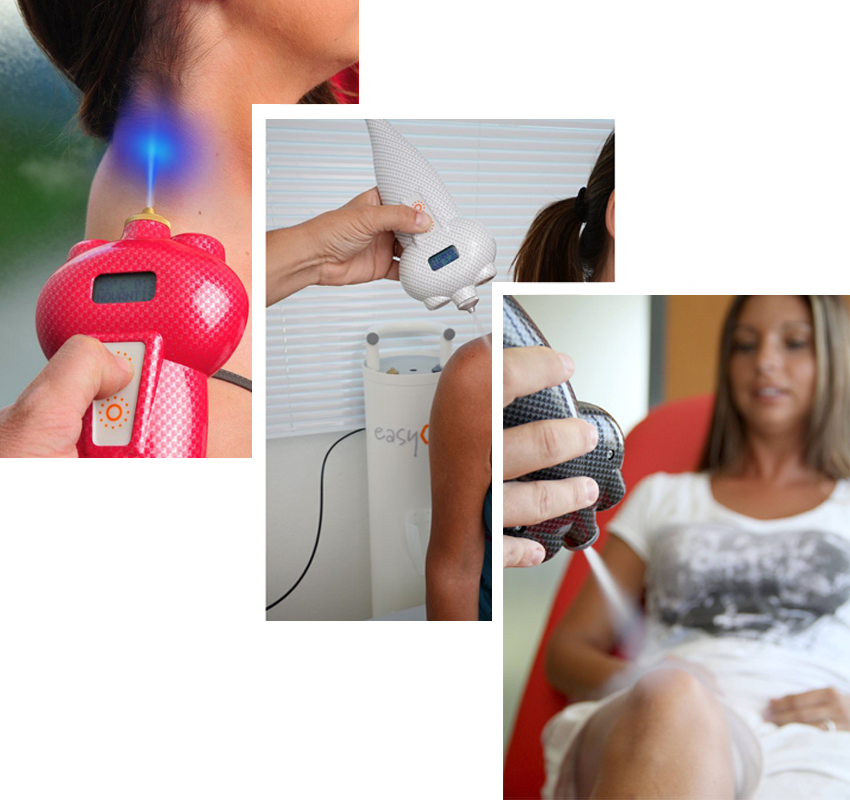 Medium Area Cryotherapy