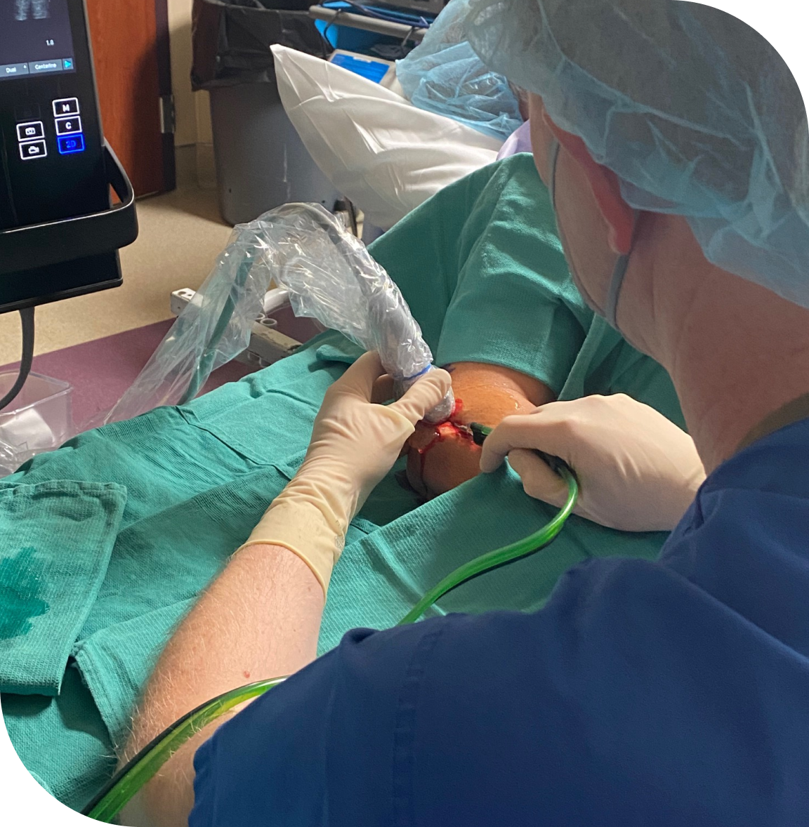 Tenex Procedure Shoulders