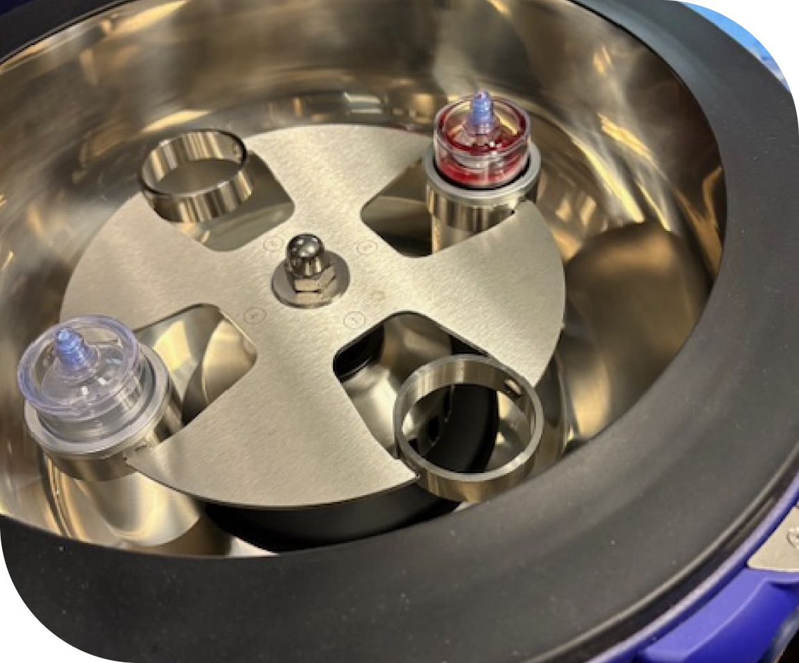 PRP Injection Recovery Time