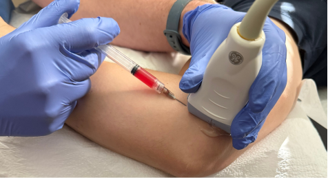 PRP: Natural, Preventative &amp; Proven