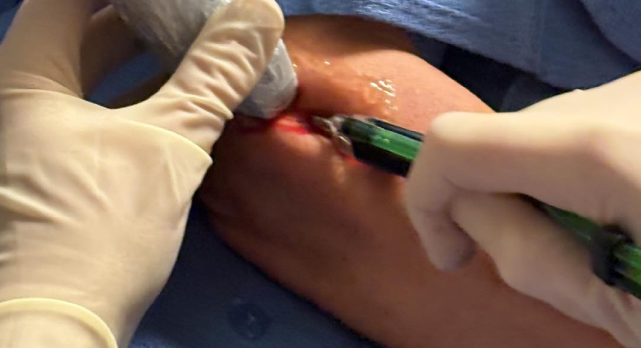 My Elbow Hurts: Why Will It Not Get Better?