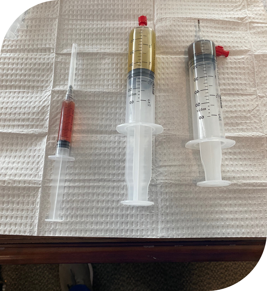 Impact Sports Medicine PRP Therapy In Nashville